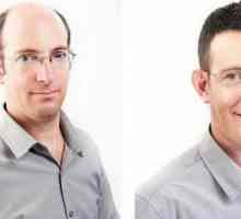 Hair Cloning: o nouă metodă pentru combaterea caderii parului