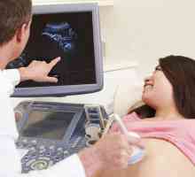 Când să faci al treilea ecograf în timpul sarcinii? La ce oră se planifică 3 ultrasunete în timpul…