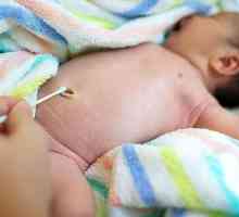 Când ombilicul vindecă nou-născutul, caracteristicile tratamentului și recomandările
