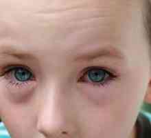 Ochii roșii la copii - o ocazie de a se întoarce la un oftalmolog