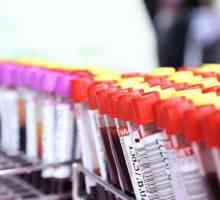 Sânge pe HCG - ceea ce este, când să ia, rezultatele