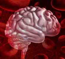 Hemoragie la nivelul creierului: simptome, tratament, consecințe, prognostic