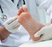 Lac de la ciuperca unghiilor la picioare: recenzii, aplicare, regimuri de tratament