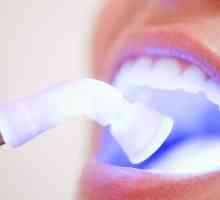 Laser albirea dinților: recenzii, plusuri și proceduri minus