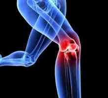Exerciții fizico-terapeutice pentru artroza articulației genunchiului: exerciții, reguli pentru…
