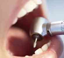Tratamentul cariilor dentare: metode și materiale moderne