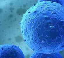 Tratamentul cu celule stem: caracteristici și eficacitate
