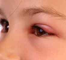 Tratamentul mușcăturii musculare în ochi în diferite moduri