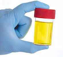 Esteraza de leucocite în urină - ce este? Esterul de leucocite în analiza urinei: transcript