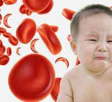 Leucocitoza la copii: cauze și tratament