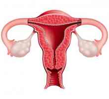 Leukoplakia - ce este în ginecologie? Simptomele, simptomele și tratamentul leucoplaxiei cervicale