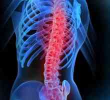 LFK pentru coloanei vertebrale: exerciții și proceduri
