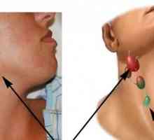 Nodul limfatic pe gât: tratament și cauze