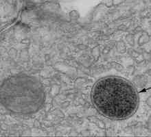 Лизосома: строение и функции органеллы клетки