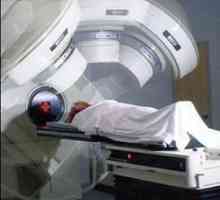 Radioterapia în oncologie. Consecințele radioterapiei