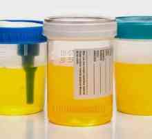 Se schimbă culoarea urinei în timpul sarcinii?