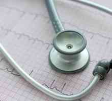 Fibrilația atrială a inimii: ce este și cât de periculoasă este aceasta?