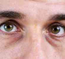 Pungile sub ochii bărbaților: cauza și tratamentul