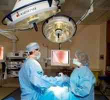Lunar după laparoscopie (eliminarea chistului ovarian)