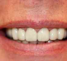 Dinți metal-ceramici. Stomatologie protetică: cermete