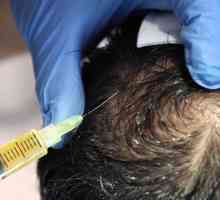 Mezoterapia pentru păr: recenzii, plusuri și proceduri minus