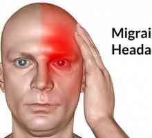 Migrenă: cum să ușurezi durerea. Cum să scapi de durerea de cap migrenă