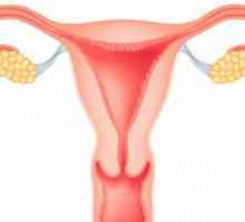 Myomii uterului (ICD 10: D 25): soiuri, simptome și tratament