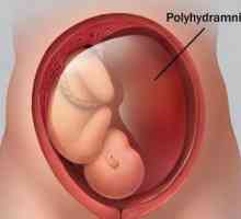 Polyhydramnios în timpul sarcinii: cauze și consecințe. Efectul poligramannios asupra travaliului