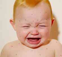 Este posibil să se spele un copil cu varicela? A dispărut varicela, când pot să-mi scot copilul?