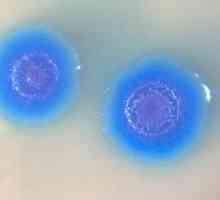 Mycoplasma genitalium: ce este? Cât de periculoasă este infecția?