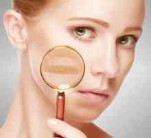 Piele de piele de culoare brun deschis: cauze și tratament