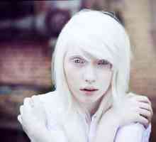 Nastya Zhidkova: model albinic cu aspect non-standard