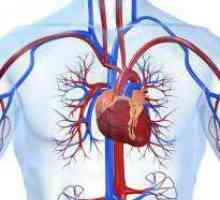 NDC pentru tipul cardiac - ce este? Descrierea diagnosticului