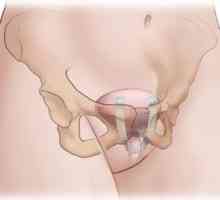 Incontinența urinei la tuse: cauze și metode de tratament