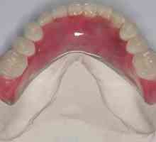 Proteză din nailă cu absența completă a dinților și parțială. Recenzii despre protezele nylon