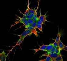 Neuroblastomul - ce este? Simptomele și tratamentul bolii