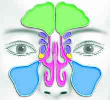 Nasul: sinusurile paranasale. CT a sinusurilor paranazale