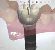 Cea mai recentă tehnologie în stomatologie: o revizuire a metodelor, a caracteristicilor și a…