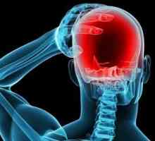 Cu privire la modul de tratare a unei migrene