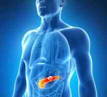 Exacerbarea pancreatitei cronice: simptome și tratament