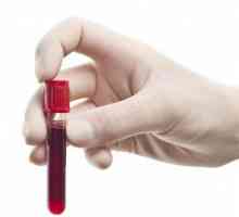 Test de sânge general. Unde iau sânge de la copii și adulți cu un test de sânge general