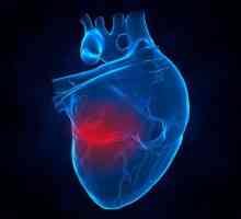 Extensiv atac de cord: consecințe, șanse de supraviețuire, reabilitare la bărbați și femei