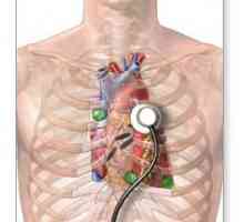 Examinarea inimii. Ecografia inimii: ce arată? Metode de examinare a inimii