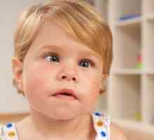 Occendent copii pentru tratamentul strabismului: o descriere, trăsăturile terapiei