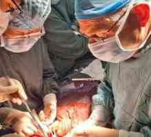 Operație pe pancreas