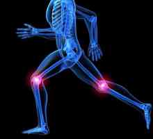 Funcționarea artroplastiei genunchiului: recenzii. Endoprotetice ale articulației genunchiului:…