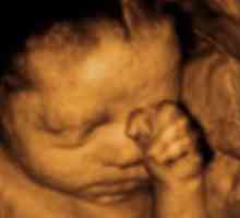 Determinarea sexului copilului prin ultrasunete, în măsura în care este corect