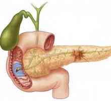 Pancreatic cancer: simptome, diagnostic, tratament
