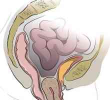 Omisiunea uterului. Simptomele și tratamentul într-un stadiu incipient