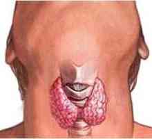 Principalul simptom al cancerului tiroidian